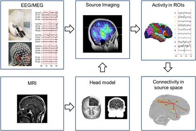 Network Perspectives on Epilepsy Using EEG/MEG Source Connectivity